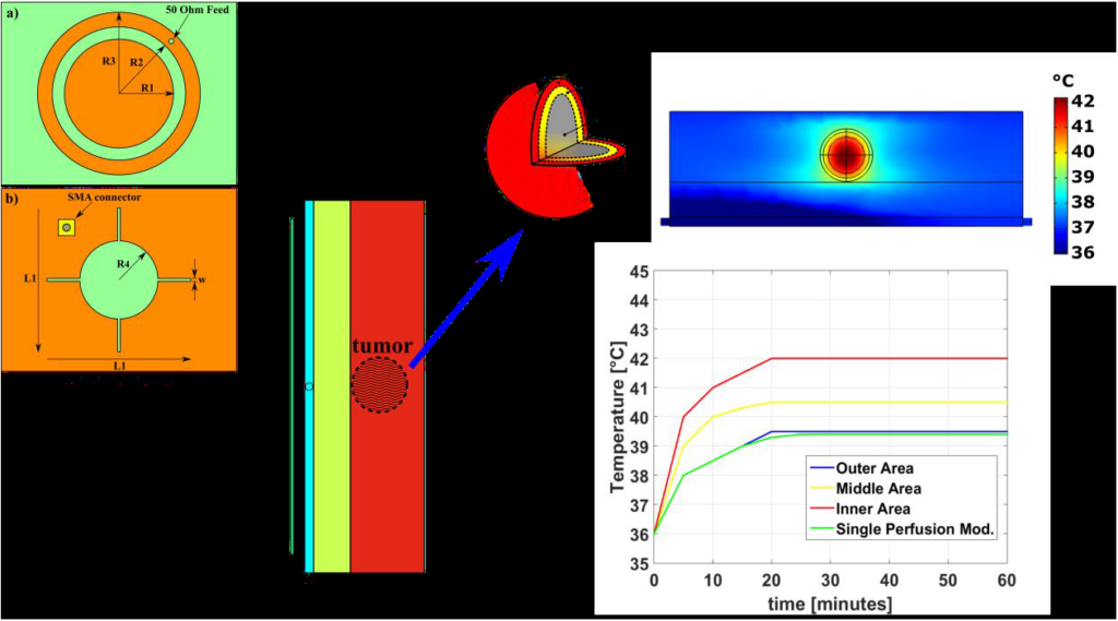 A Blood Perfusion Model Of A RMS Tumor In A Local Hyperthermia Multi-Physic Scenario: A Preliminary Study