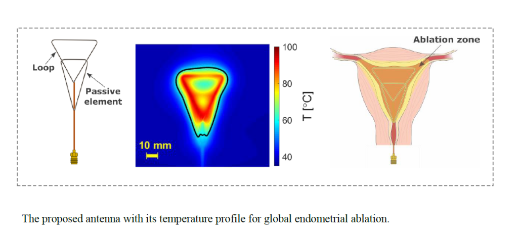 Design of a Microwave Global Endometrial Ablation Device
