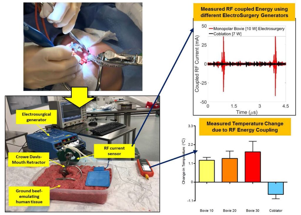 Unintentional RF Energy Transfer During Tonsillectomy: An In Vitro Investigation