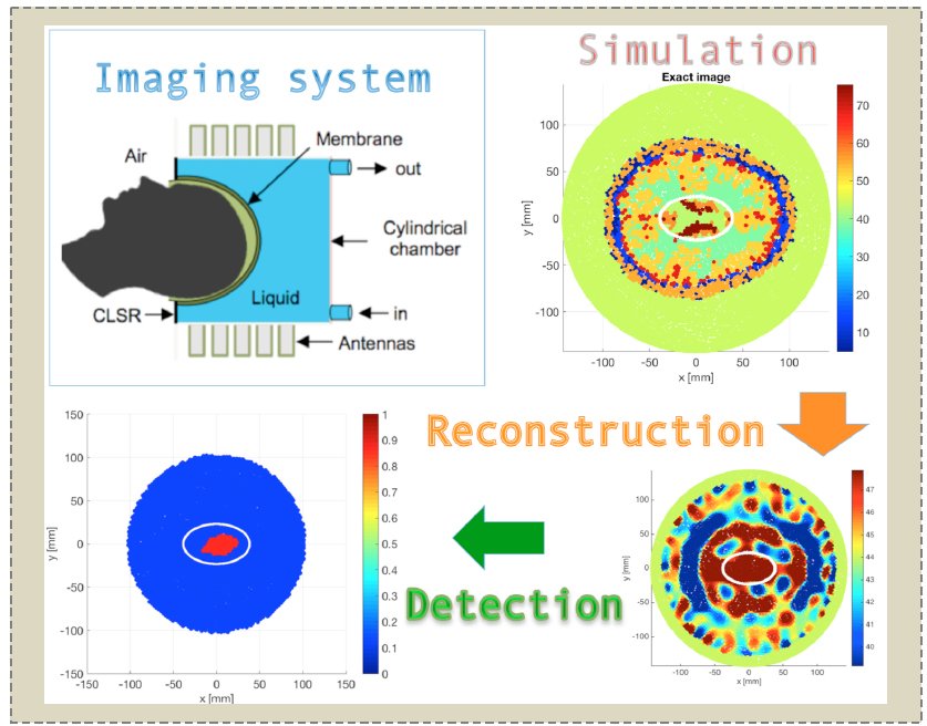Detection of Simulated Brain Strokes Using Microwave Tomography
