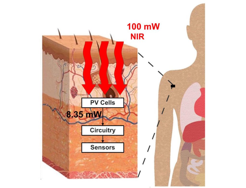 Photovoltaic Power Harvesting Technologies in Biomedical Implantable Devices Considering the Optimal Location