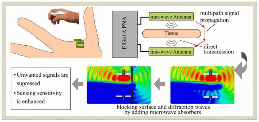 Study and Suppression of Multipath Signals in a Non-Invasive Millimeter Wave Transmission Glucose Sensing System