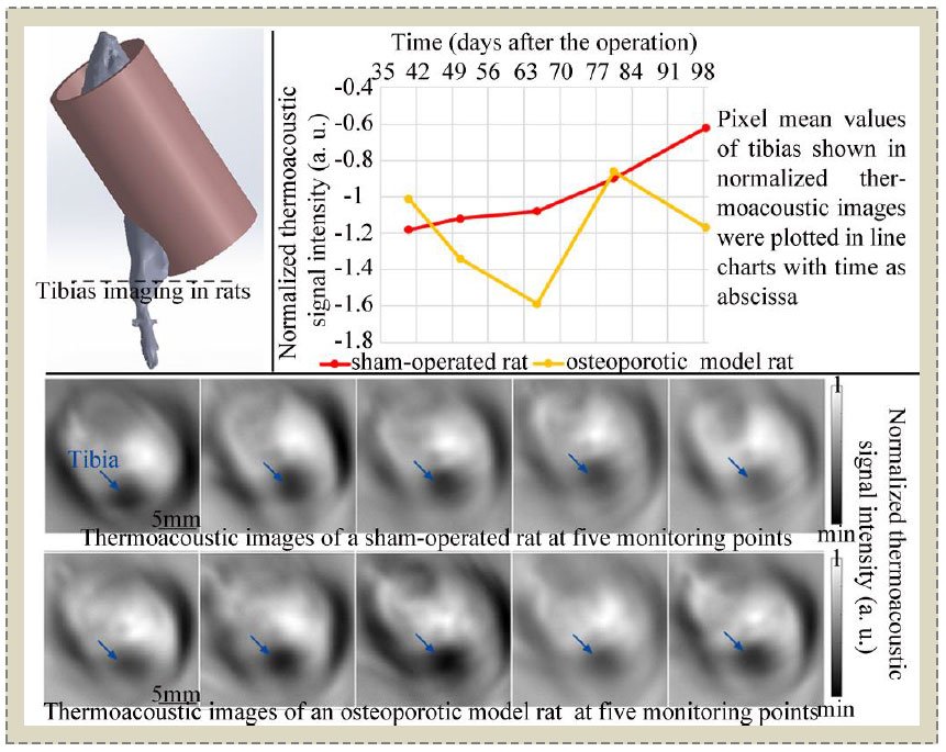 Detection and Monitoring of Osteoporosis in a Rat Model by Thermoacoustic Tomography
