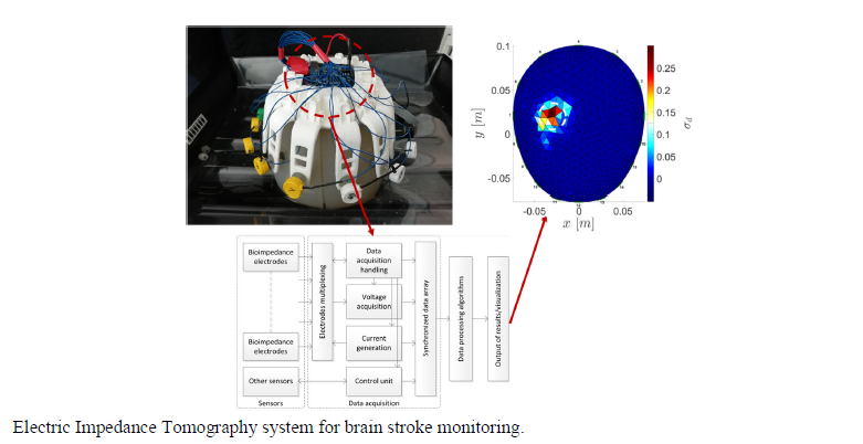 An Electrical Impedance Tomography System for Brain Stroke Imaging based on a Lebesgue-Space Inversion Procedure