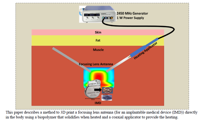 Design of an Interstitial Microwave Applicator for 3D Printing in the Body