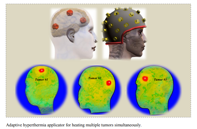 Design of Hyperthermia Applicator to Heat Multi Brain Tumors Simultaneously based on Adaptive Beamforming Technique