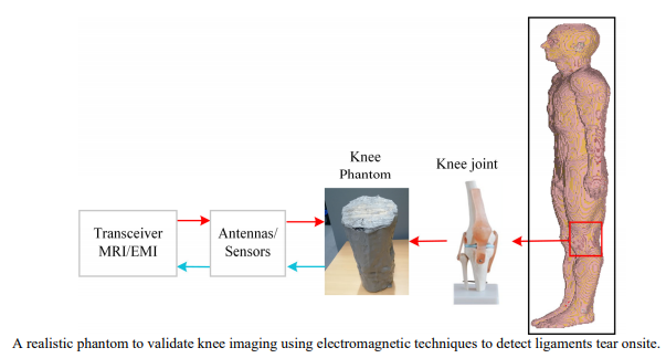 Anthropomorphic Durable Realistic Knee Phantom for Testing Electromagnetic Imaging Systems