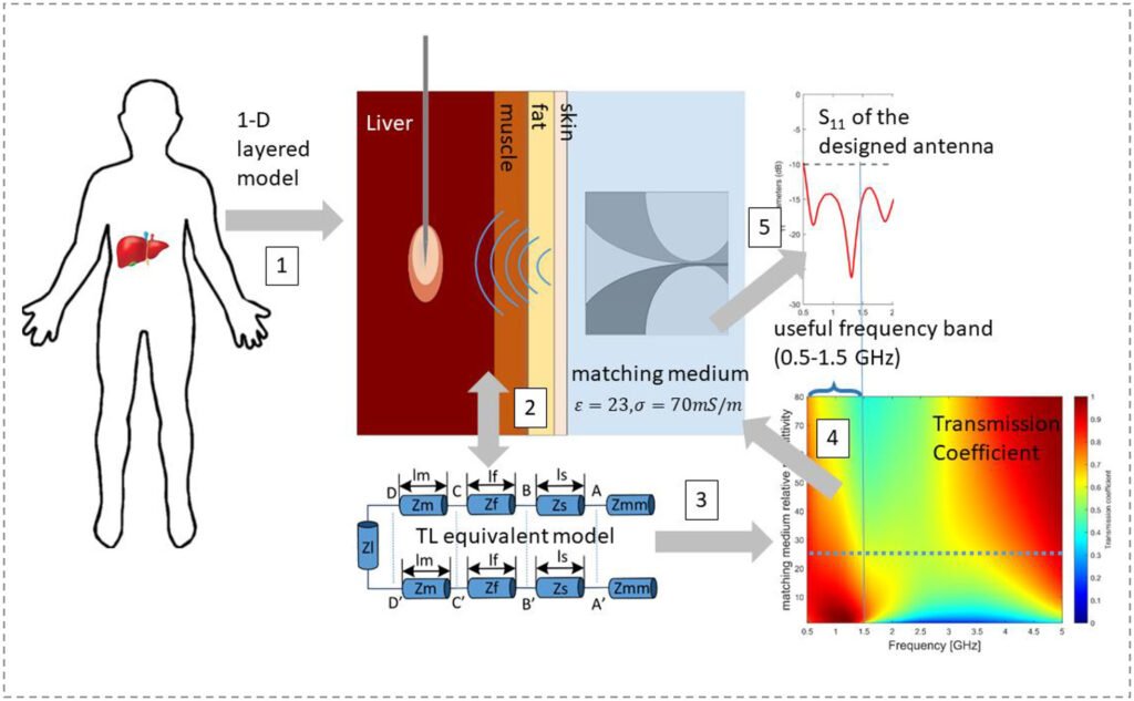 On the Design of a Microwave Imaging System to Monitor Thermal Ablation of Liver Tumors