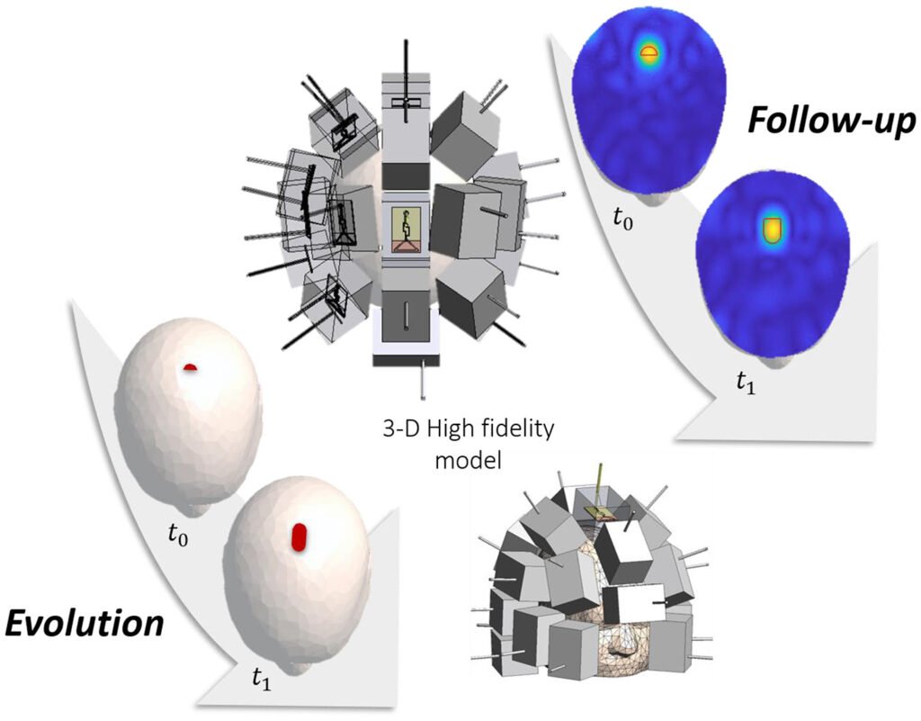 Assessing a Microwave Imaging System for Brain Stroke Monitoring via High Fidelity Numerical Modelling