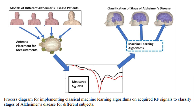 Classification of Alzheimers Disease using RF Signals and Machine Learning