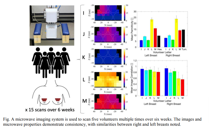 Microwave Imaging of the Breast: Consistency of Measurements over Time