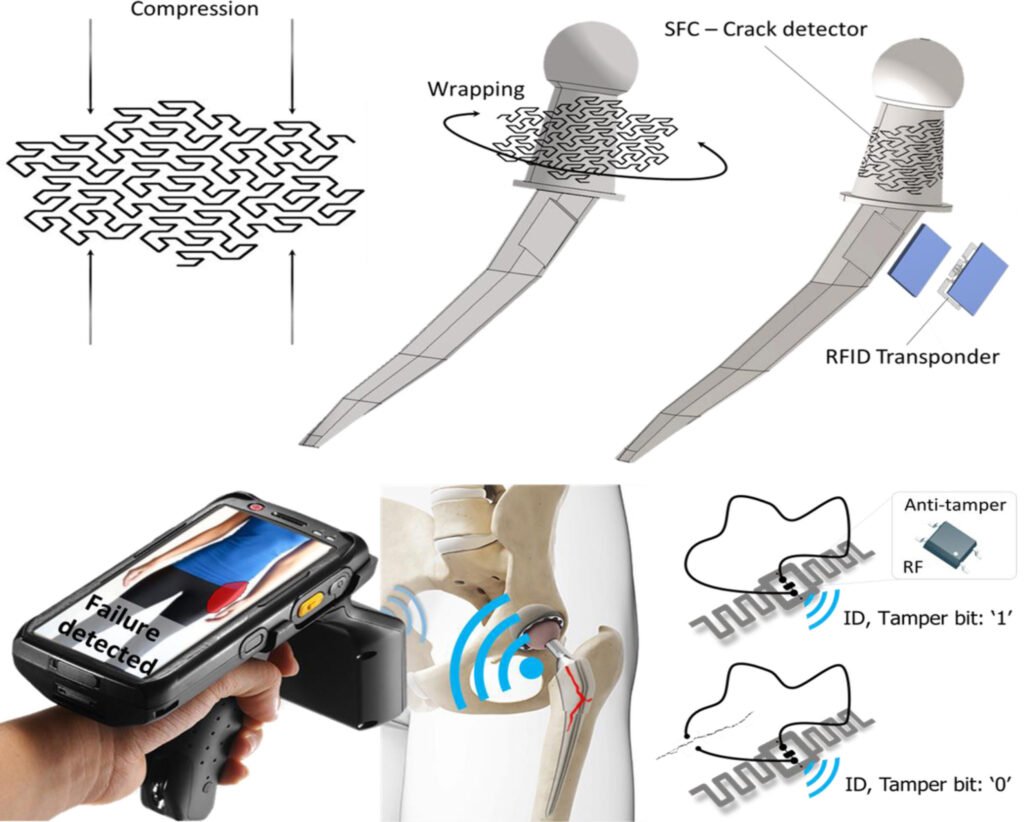 A Fractal-RFID Based Sensing Tattoo for the Early Detection of Cracks in Implanted Metal Prostheses