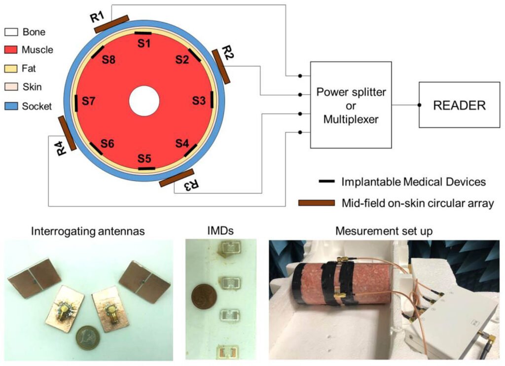 Near-Field Circular Array for the Transcutaneous Telemetry of UHF RFID-Based Implantable Medical Devices