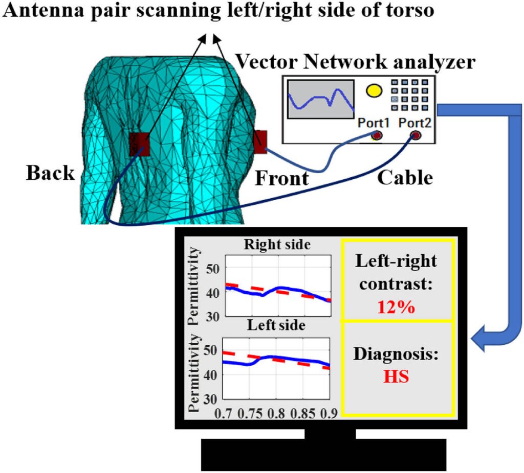 Electromagnetic Method for Steatotic Liver Detection Using Contrast in Effective Dispersive Permittivity