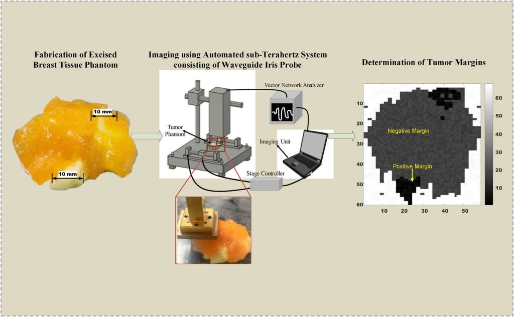Sub-Terahertz Waveguide Iris Probe for Ex-Vivo Breast Cancer Tumor Margin Assessment