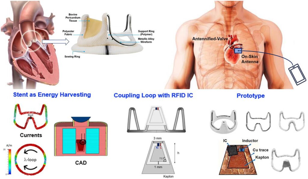 Wireless and Zero-Power Trans-Cardiac Link With Antennified Aortic Valve Bioprostheses