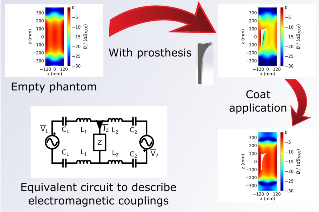A Near Field Cloaking Study to Reduce MRI RF-Artefacts in Presence of Elongated Prostheses