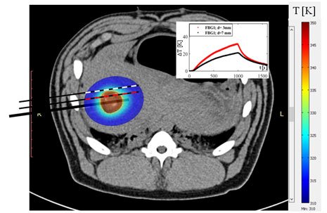 Solutions to improve the outcomes of thermal treatments in oncology: multi-point temperature monitoring