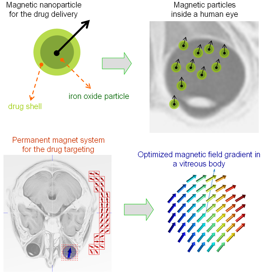 Magnetic Targeted Drug Delivery to the Human Eye Retina: an Optimization Methodology