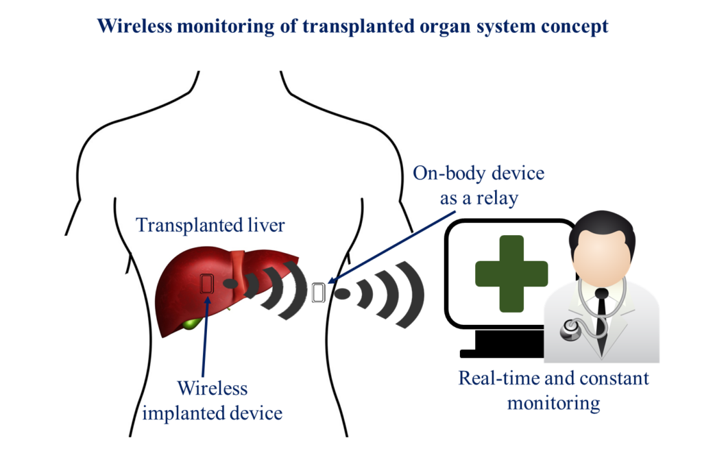 Channel Characteristics and Wireless Telemetry Performance of Transplanted Organ Monitoring System Using Ultra-wideband Communication