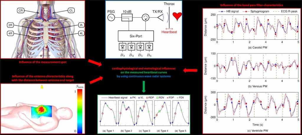 Local Pulse Wave Detection using Continuous Wave Radar Systems