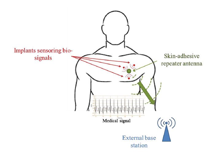Dual-Band Skin-Adhesive Repeater Antenna for Continuous Body Signals Monitoring